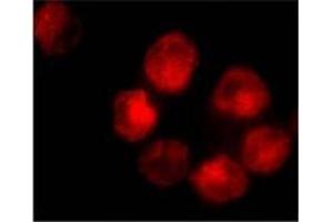 Immunofluorescence staining of K562 cells using AP30017PU-N ADAM10 antibody at 10 μg/ml. (ADAM10 antibody  (C-Term))