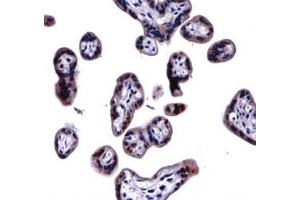 SOCS6 antibody immunohistochemistry analysis in formalin fixed and paraffin embedded human placenta tissue. (SOCS6 antibody  (AA 40-69))