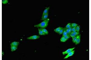 Immunofluorescent analysis of HepG2 cells using ABIN7176064 at dilution of 1:100 and Alexa Fluor 488-congugated AffiniPure Goat Anti-Rabbit IgG(H+L) (ZFYVE26 antibody  (AA 2306-2473))