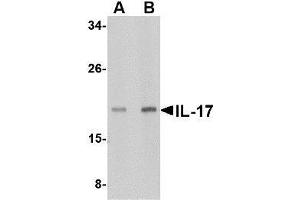 Western blot analysis of IL-17 in A-20 lysate with AP30409PU-N IL-17 antibody at (A) 2 and (B) 4 μg/ml.