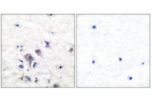 Immunohistochemistry (IHC) image for anti-Glutamate Receptor, Ionotropic, AMPA 2/3 (GRIA2/3) (C-Term) antibody (ABIN1848570)