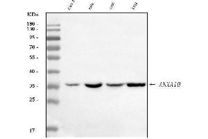 Western blot analysis of Annexin A10/ANXA10 using anti-Annexin A10/ANXA10 antibody (ABIN7601853).