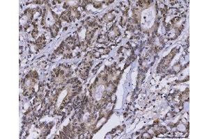 IHC analysis of MLH1 using anti-MLH1 antibody (ABIN7599691).
