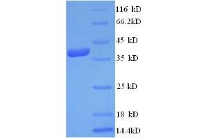 SDS-PAGE (SDS) image for C-Fos Induced Growth Factor (Vascular Endothelial Growth Factor D) (Figf) (AA 89-205) protein (GST tag) (ABIN5712536)