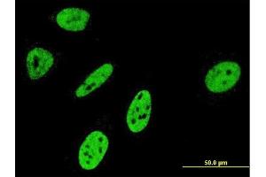 Immunofluorescence of monoclonal antibody to NOTCH3 on HeLa cell. (NOTCH3 antibody  (AA 47-156))