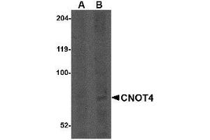 Western blot analysis of CNOT4 in A549 lysate with AP30240PU-N CNOT4 antibody at (A) 1 and (B) 2 μg/ml.