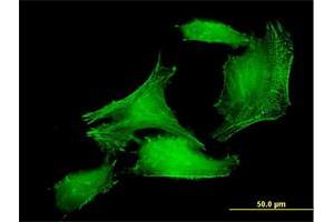 Immunofluorescence of purified MaxPab antibody to PDLIM7 on HeLa cell. (PDLIM7 antibody  (AA 1-457))