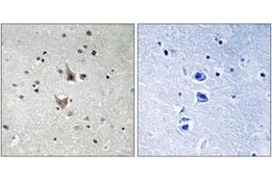 Immunohistochemistry analysis of paraffin-embedded human brain, using PSEN1 (Phospho-Ser357) Antibody. (Presenilin 1 antibody  (pSer357))