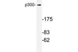 Western blot analysis with EP300 / P300 antibody in extracts from MDA-MB-435 cells.