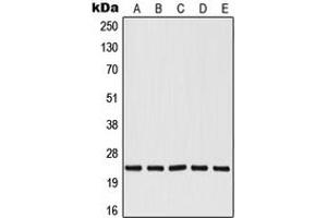 Western blot analysis of RALB expression in HepG2 (A), Jurkat (B), A549 (C), NIH3T3 (D), PC12 (E) whole cell lysates.