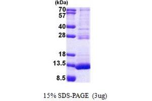 Thiosulfate Sulfurtransferase (Rhodanese)-Like Domain Containing 3 (TSTD3) (AA 1-97) protein (His tag)