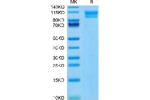 Human IL-17Rc on Tris-Bis PAGE under reduced condition. (IL17RC Protein (AA 21-467) (Fc Tag))
