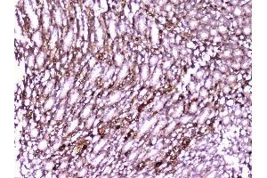 IHC analysis of PON1 using anti-PON1 antibody (ABIN6719356). (PON1 antibody  (AA 30-274))