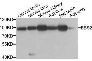 Western blot analysis of extracts of various cell lines, using BBS2 antibody (ABIN5975143) at 1/1000 dilution.
