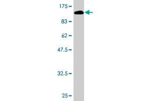 Western Blot detection against Immunogen (106. (VCAM1 antibody  (AA 1-739))