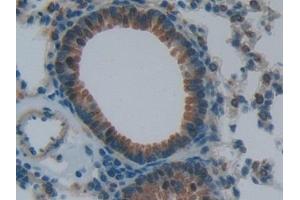 Detection of NPPB in Mouse Lung Tissue using Polyclonal Antibody to Natriuretic Peptide Precursor B (NPPB) (NPPB antibody  (AA 27-121))
