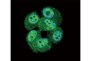 Confocal immunofluorescent analysis of AKT antibody with MCF-7 cells followed by Alexa Fluor 488-conjugated goat anti-rabbit lgG (green). (AKT1 antibody  (AA 428-457))
