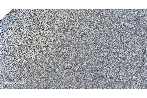 IHC analysis of LSM8 using anti-LSM8 antibody (ABIN7599579).