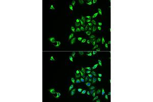Immunofluorescence analysis of HeLa cells using CSNK1A1L antibody (ABIN5973884).