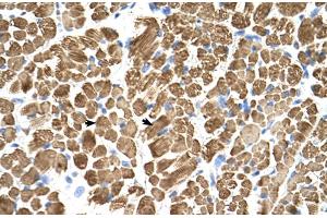 Human Muscle (TPM2 antibody  (C-Term))