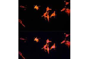 Immunofluorescence (IF) image for anti-Macrophage Stimulating 1 (Hepatocyte Growth Factor-Like) (MST1) (AA 200-500) antibody (ABIN6144095)