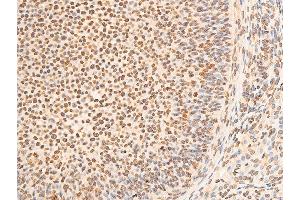 Immunohistochemistry (IHC) image for anti-Eukaryotic Translation Initiation Factor 2 Subunit 1 (EIF2S1) (pSer51) antibody (ABIN6255389)