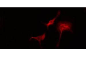 ABIN6274767 staining Hela cells by IF/ICC. (RPL11 antibody  (C-Term))