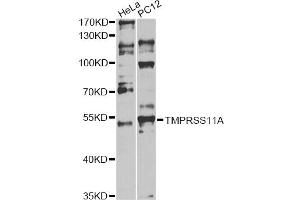 Western blot analysis of extracts of various cell lines, using TMPRSS11A antibody. (TMPRSS11A antibody)