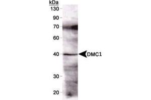 Western blot detection of DMC1 (37 kDa) from mouse testis using DMC1 monoclonal antibody, clone 1D12/4  (1 : 1000). (DMC1 antibody)