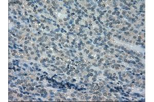 Immunohistochemistry (IHC) image for anti-Dihydrofolate Reductase (DHFR) antibody (ABIN1497822) (Dihydrofolate Reductase antibody)