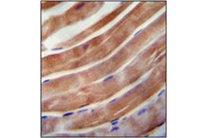 Immunohistochemistry analysis in formalin fixed and paraffin embedded human skeletal muscle reacted with KEAP1 Antibody (C-term) followed which was peroxidase conjugated to the secondary antibody and followed by DAB staining. (KEAP1 antibody  (C-Term))