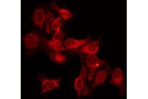 ABIN6272450 staining SKOV3 by IF/ICC. (THRA antibody  (N-Term))