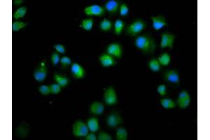 Immunofluorescence staining of Hela cells with ABIN7158363 at 1:66, counter-stained with DAPI. (LMO7 antibody  (AA 1301-1465))