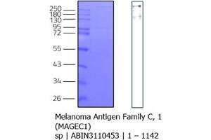 Western Blotting (WB) image for Melanoma Antigen Family C, 1 (MAGEC1) (AA 1-1142) protein (Strep Tag) (ABIN3093750) (MAGEC1 Protein (AA 1-1142) (Strep Tag))