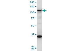 HIP1R monoclonal antibody (M01A), clone 3E10 Western Blot analysis of HIP1R expression in A-431 . (HIP1R antibody  (AA 969-1066))