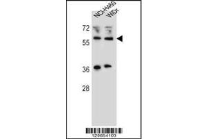 Western blot analysis in NCI-H460,WiDr cell line lysates (35ug/lane). (WTIP antibody  (AA 243-271))