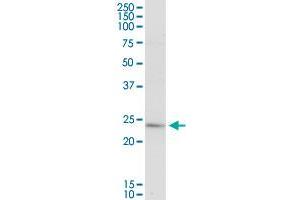 PLA2G16 MaxPab rabbit polyclonal antibody. (PLA2G16 antibody  (AA 1-162))