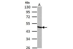 WB Image Fumarate hydratase antibody detects Fumarate hydratase protein by Western blot analysis. (FH antibody)