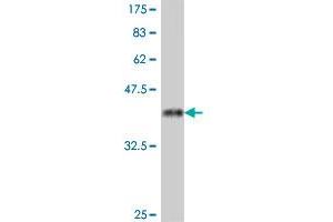 Western Blot detection against Immunogen (38. (PSMA antibody  (AA 547-656))