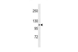 Western blot analysis in A375 cell line lysates (35ug/lane). (FARP1 antibody  (N-Term))
