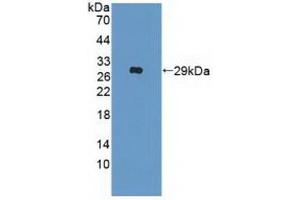 Detection of Recombinant IFNa/bR2, Human using Polyclonal Antibody to Interferon Alpha/Beta Receptor 2 (IFNa/bR2) (IFNAR2 antibody  (AA 27-243))