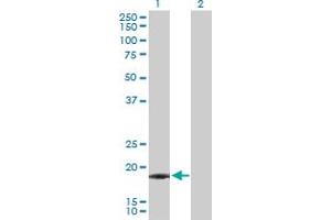 Western Blot analysis of IFNA21 expression in transfected 293T cell line by IFNA21 MaxPab polyclonal antibody.