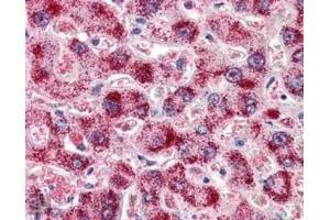 Immunohistochemistry (IHC) image for anti-Catalase (CAT) (Internal Region) antibody (ABIN185651)