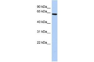 WB Suggested Anti-CCDC96 Antibody Titration: 0. (CCDC96 antibody  (N-Term))