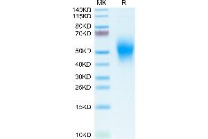 CD300a Protein (CD300A) (AA 18-180) (His tag)