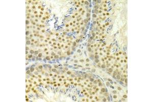 Immunohistochemistry (Paraffin-embedded Sections) (IHC (p)) image for anti-Mitogen-Activated Protein Kinase 3 (MAPK3) (AA 1-100) antibody (ABIN3020725)