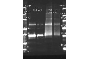 Goat anti Uricase antibody was used to detect purified Uricase under reducing and non-reducing conditions. (Urate Oxidase antibody)