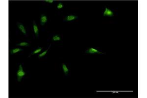 Immunofluorescence of monoclonal antibody to MDFI on HeLa cell. (MDFI antibody  (AA 33-110))