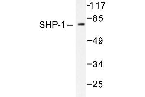 Image no. 1 for anti-Protein-tyrosine Phosphatase 1C (PTPN6) antibody (ABIN271911) (SHP1 antibody)