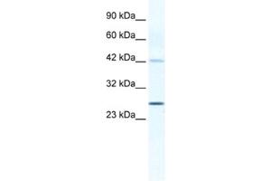 Western Blotting (WB) image for anti-Gap Junction Protein, beta 4, 30.3kDa (GJB4) antibody (ABIN2461387) (GJB4 antibody)
